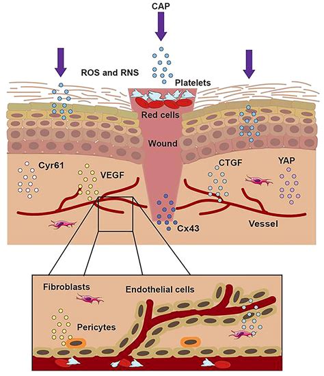 Frontiers | Cold Atmospheric Plasma Ameliorates Skin Diseases Involving ...