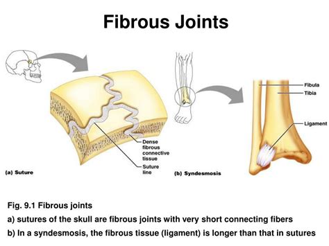 Fibrous Joint Diagram