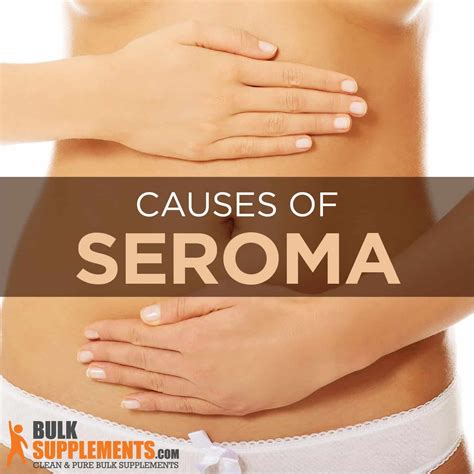 What is a Seroma: Causes, Characteristics & Treatment