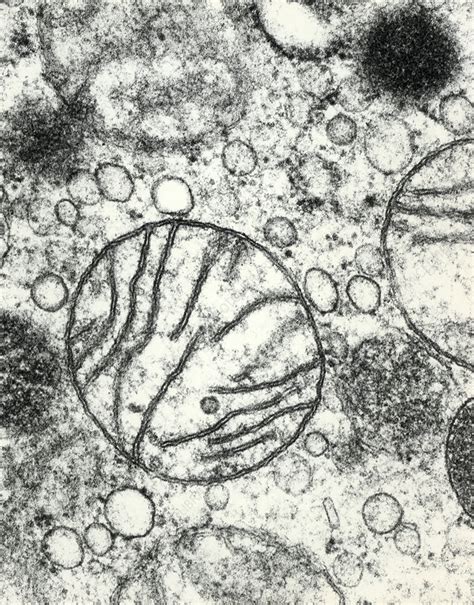 TEM view of mitochondria - Stock Image - G465/0036 - Science Photo Library