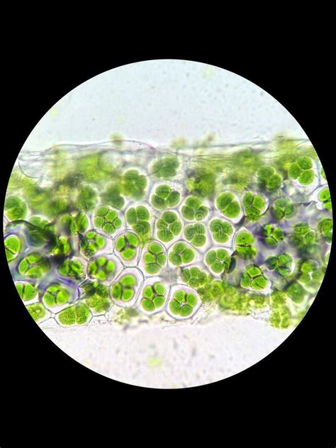 Plant cell with chloroplast under microscope. Plant cell with ...