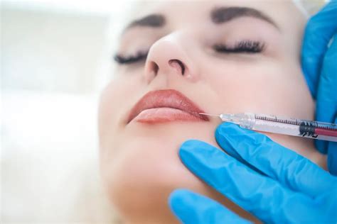 How Much Does It Cost to Dissolve Lip Fillers?