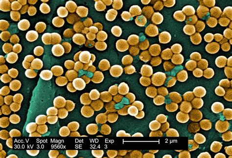 1928 - Staphylococcus aureus