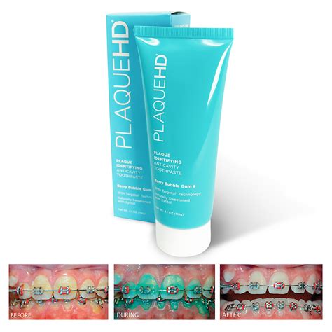 PlaqueHD Toothpaste - Ortho Technology