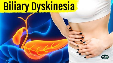 Biliary Dyskinesia: Symptoms and Causes You Must Know - YouTube