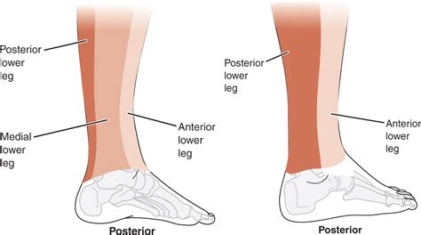 [DIAGRAM] Diagram Of Leg Pain - MYDIAGRAM.ONLINE