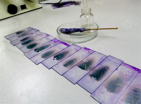 Stained Glass Slides Of Peripheral Blood Smear With Violet, 51% OFF