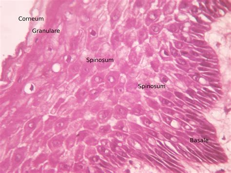 into the roots: Stratified squamous epithelium