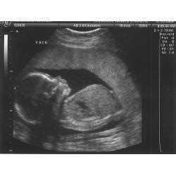 35 Week Pregnancy Ultrasound - PregnancyWalls