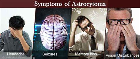 Astrocytoma - Causes, Symptoms, Diagnosis & Treatment