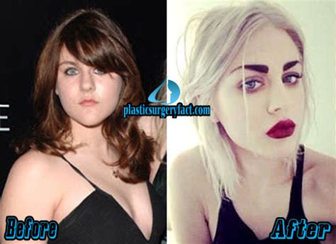 Frances Bean Cobain Plastic Surgery Before and After Photos