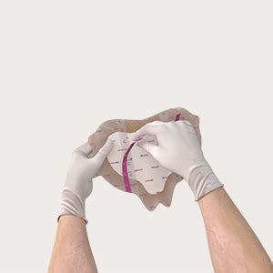 Mepilex Border Sacrum dressing for wound prevention and treatment | Mölnlycke