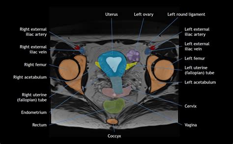 Female Pelvic Anatomy Ultrasound