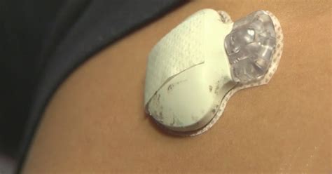 'Artificial Pancreas' Expected To Make Life Easier, Healthier For Type ...