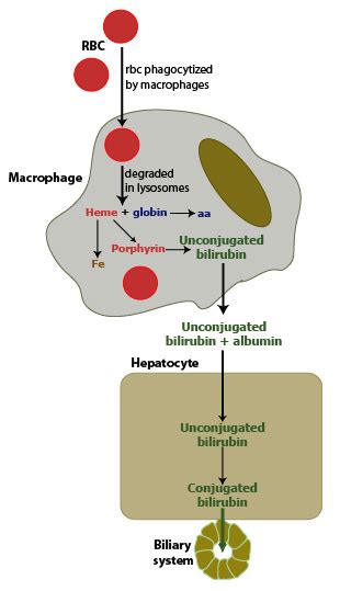 Production of bilirubin with hemolysis | eClinpath