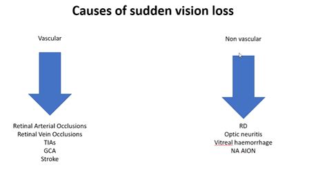 Sudden Loss of Vision – OPTOMETRY EVOLUTION