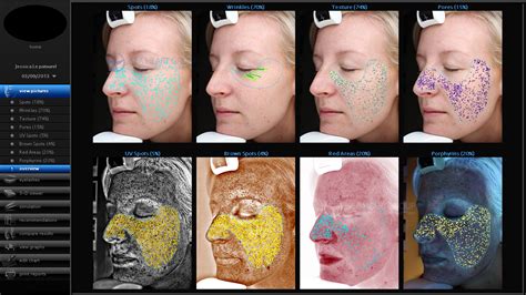 VISIA - CR Skin Analysis Facial Imaging System for Clinical Research