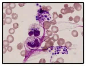 Wright's Stain - Procedure, Principle, Components, Uses and Blood smear ...