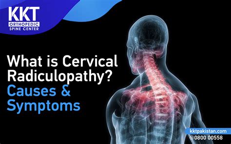 What is Cervical Radiculopathy? Causes and Symptoms - KKT Pakistan | Pakistan's Only Non ...