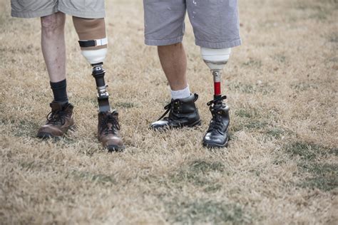 What everyone should Know About Prosthetic Legs | Premier Prosthetic