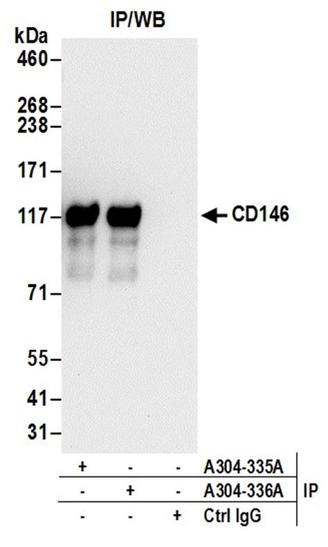 CD146 Antibody (A304-335A)