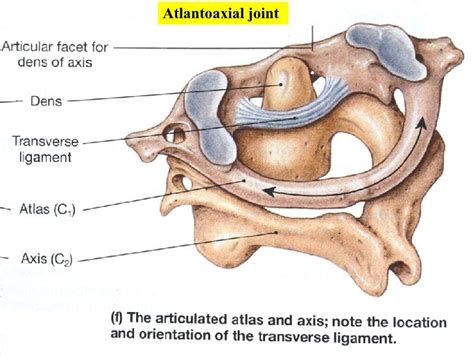 Pin on cervical vertebra