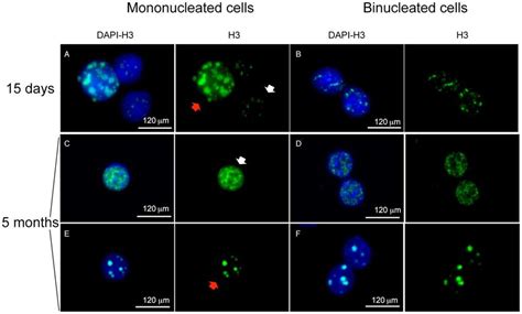 Immunofluorescence with anti-histone H3S10P antibody. (A, B) Examples ...