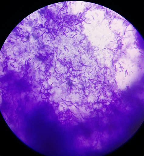 Actinomycetes viewed under a microscope