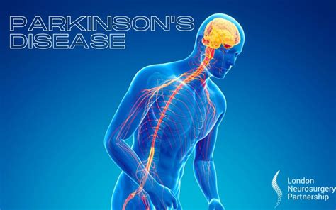 Vascular Parkinson's Disease