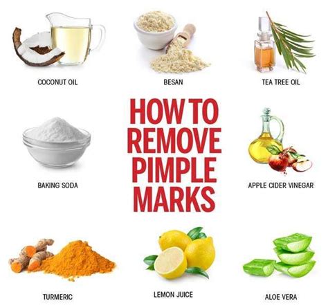 How To Remove Pimple Marks Effective Ways | Femina.in | How to remove ...