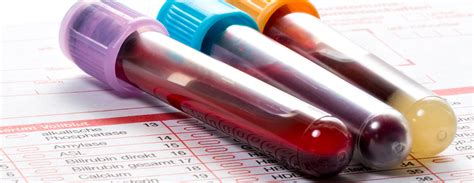 Parathyroid hormone-related protein blood test