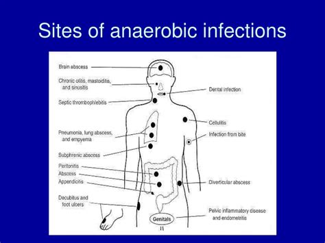 PPT - Anaerobes PowerPoint Presentation, free download - ID:2971015