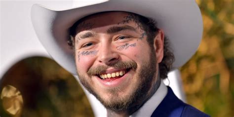 Post Malone's Smile and "Diamond Fangs" Cost $1.6 Million | POPSUGAR Beauty UK