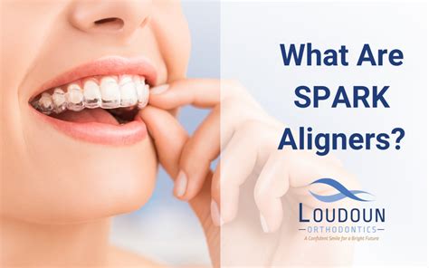 SPARK Aligners – Loudoun Orthodontics