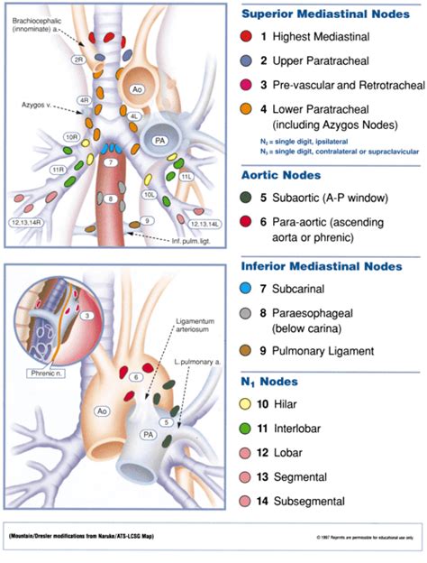 Figure 1 from Regional lymph node classification for lung cancer staging. | Semantic Scholar