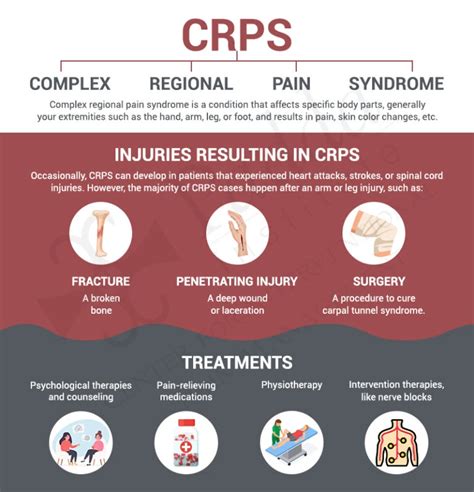 Complex Regional Pain Syndrome Treatment Specialists