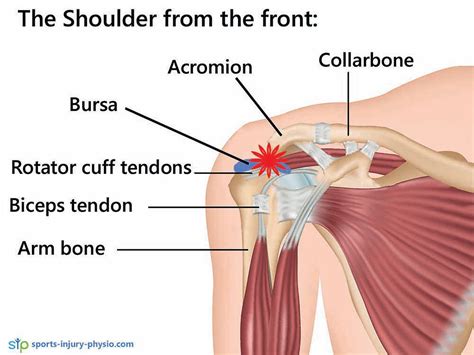 Shoulder Impingement – A common cause of shoulder pain | Sports Injury ...