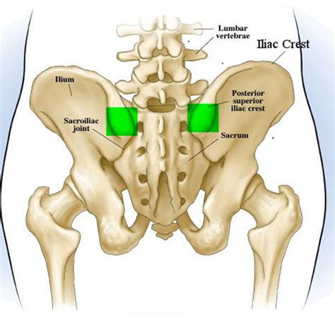 Bone Marrow Donation - How to Donate, Bone Marrow Donation Risks