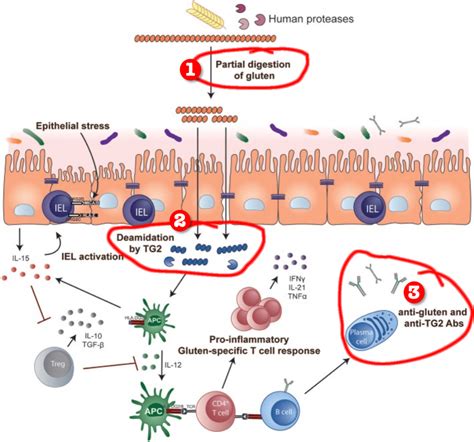 What's Behind the Rise in Gluten Toxicity? Hypothesis 2 – Food Glues ...