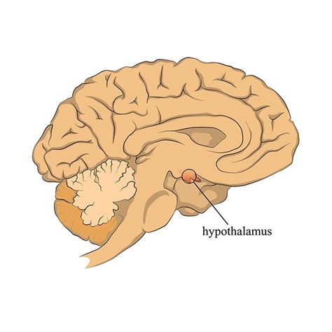 Hypothalamic Dysfunction