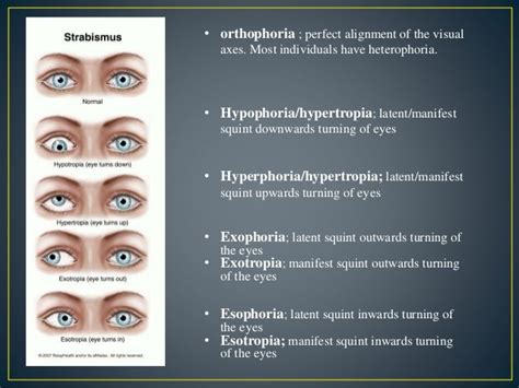 Strabismus-Clinical Examinations