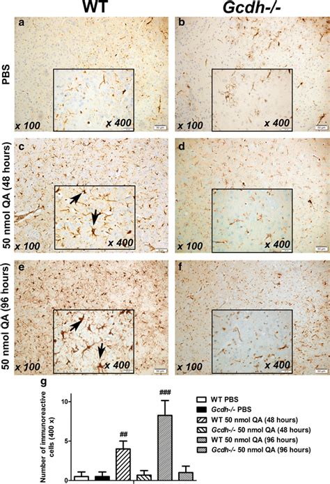 Light microscopy images showing GFAP immunohistochemistry staining in... | Download Scientific ...