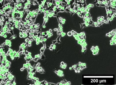 Live cell imaging