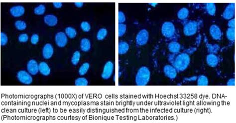 How can I spot mycoplasma contamination?