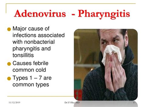 PPT - ADENOVIRUS PowerPoint Presentation, free download - ID:853325