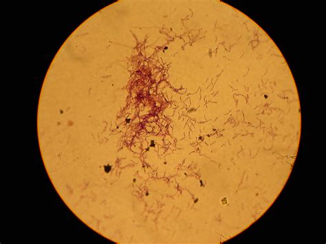 Gram stain of Actinomyces israelii colony | Gram stain of a … | Flickr