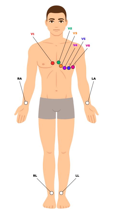 12-Lead ECG Placement Guide - CardiacDirect
