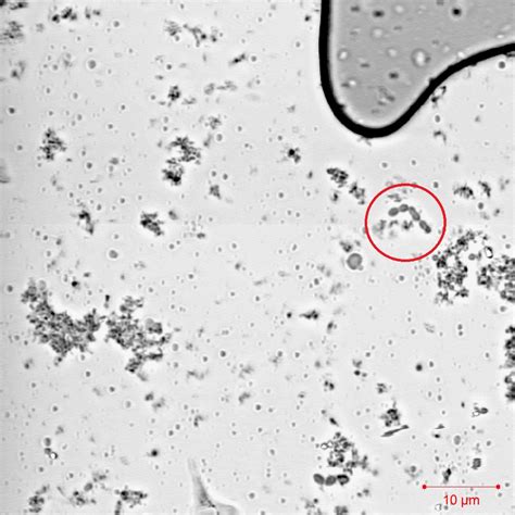 File:Streptococcus thermophilus 10 microns.jpg - Wikimedia Commons