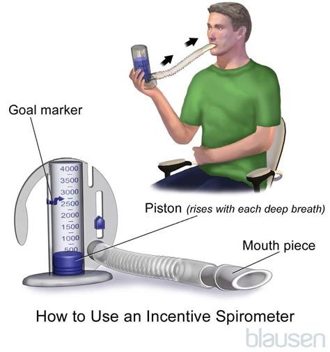 Image: Incentive Spirometer - MSD Manual Consumer Version