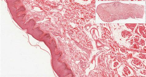 Oral Cavity and Salivary Glands | histology